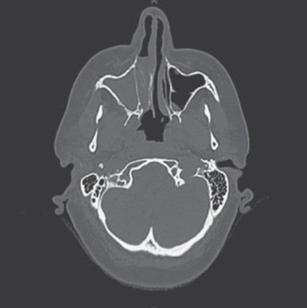 Image for stem 2